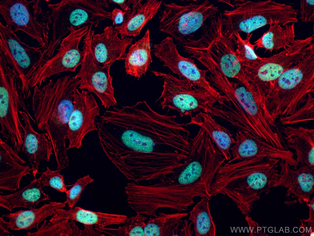 CoraLite®488-conjugated CREST Polyclonal antibody
