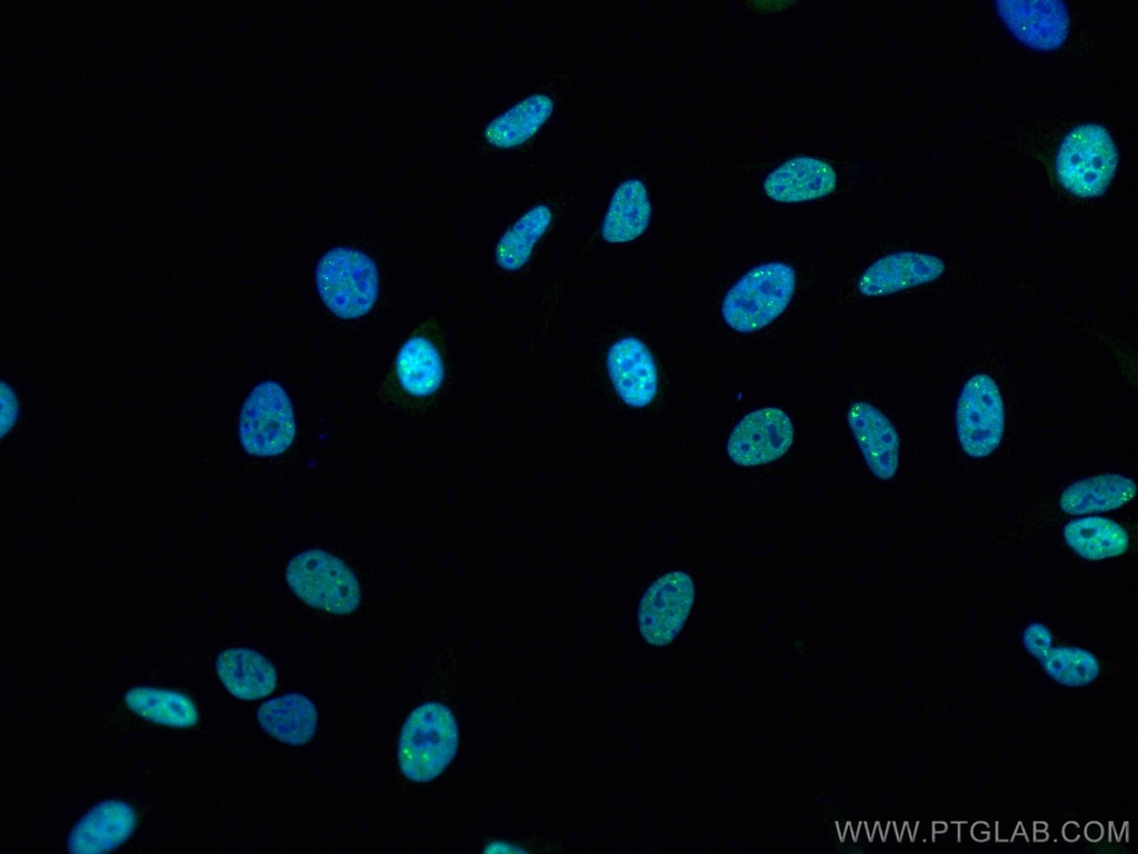 CoraLite®488-conjugated TDP-43 (C-terminal) Polyclonal antibody
