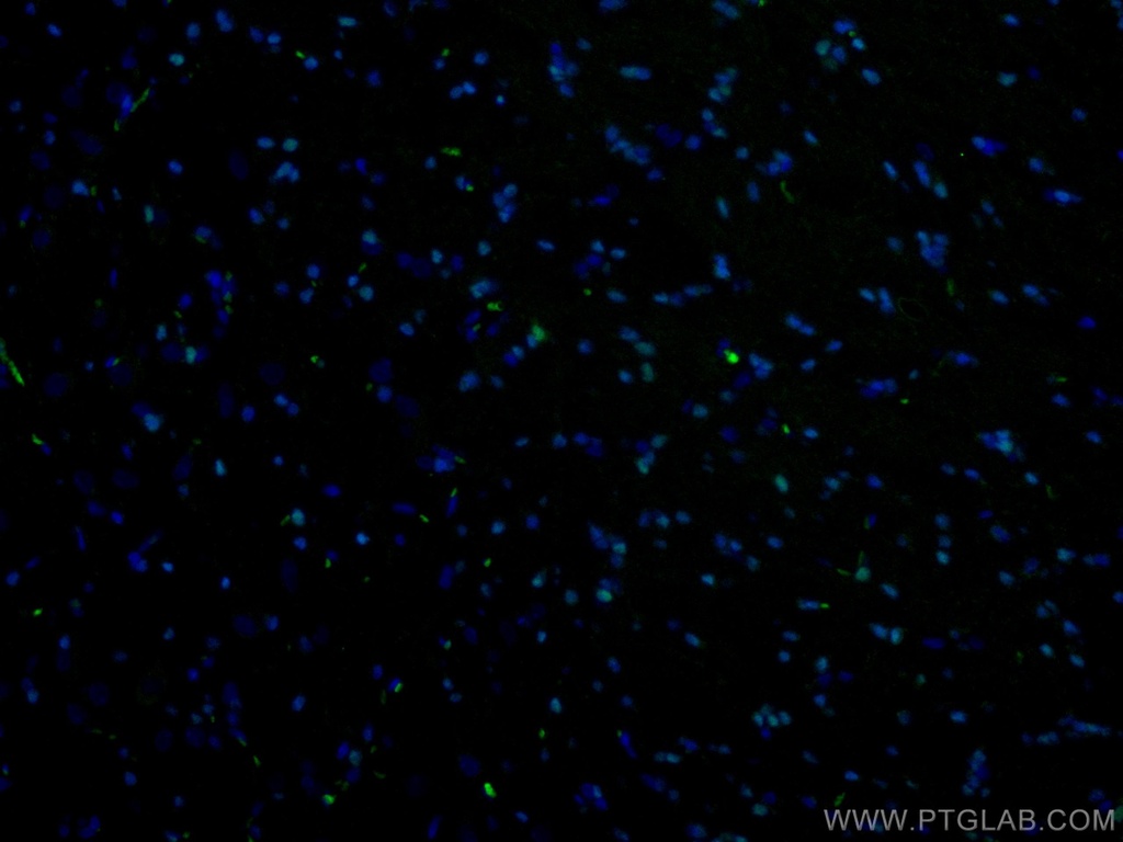 CoraLite®488-conjugated OLIG2 Polyclonal antibody