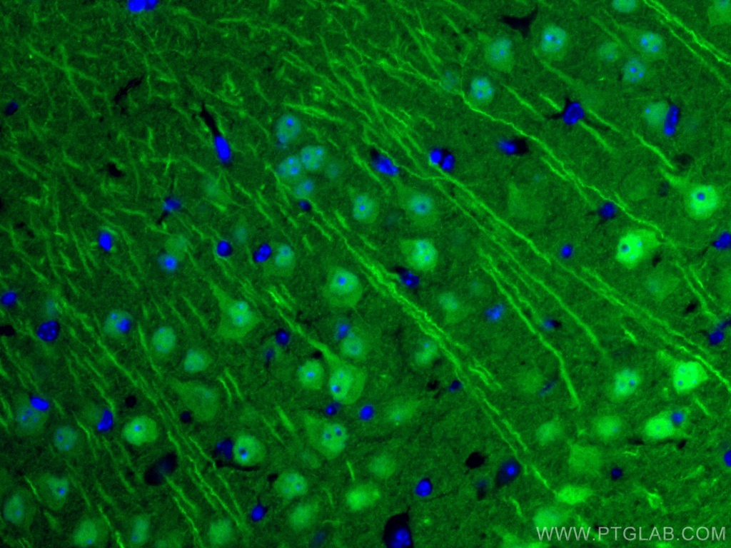 CoraLite®488-conjugated UCHL1/PGP9.5 Polyclonal antibody