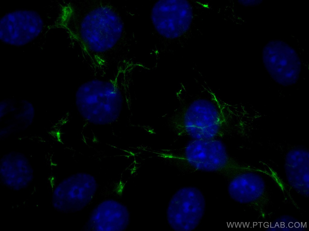 CoraLite®488-conjugated Fibronectin Polyclonal antibody