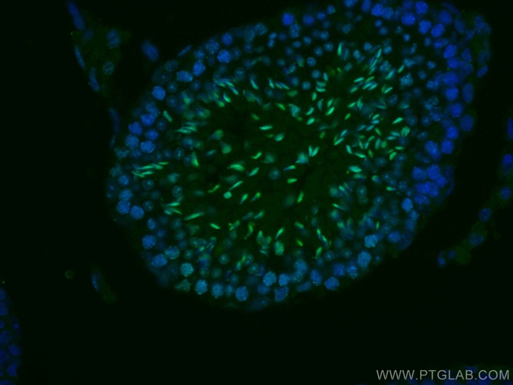 CoraLite®488-conjugated TNP1 Polyclonal antibody