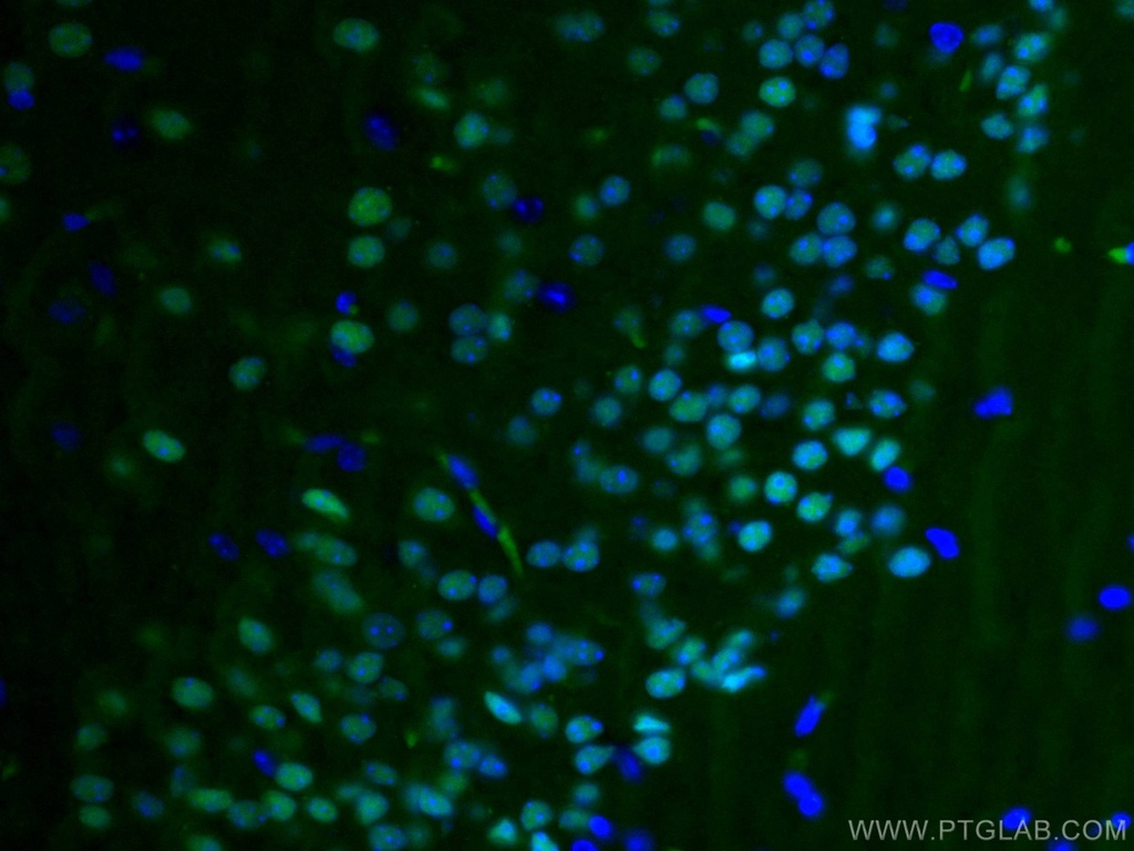 CoraLite®488-conjugated TBR1 Polyclonal antibody
