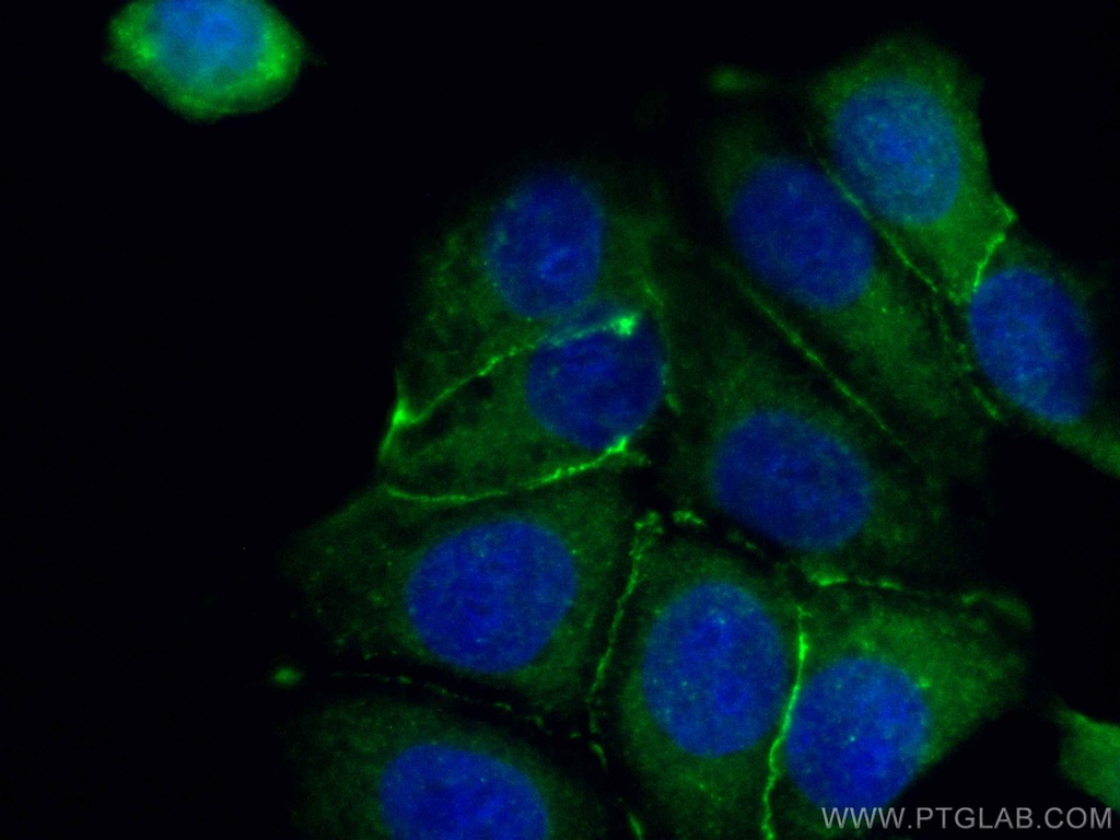 CoraLite®488-conjugated Beta Catenin Polyclonal antibody
