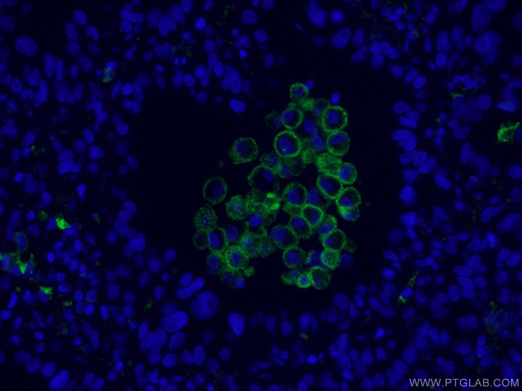 CoraLite®488-conjugated CD206 Monoclonal antibody