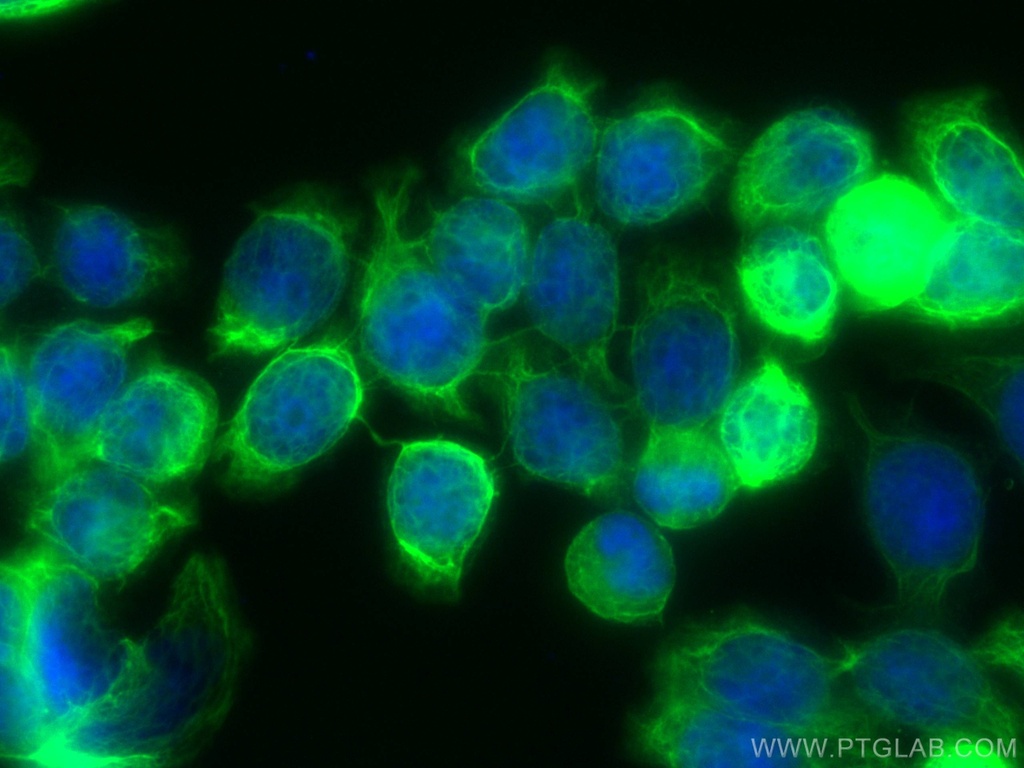 CoraLite®488-conjugated Cytokeratin 20 Monoclonal antibody