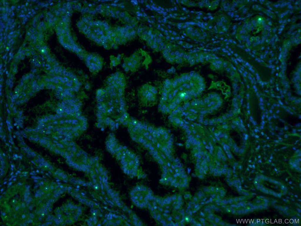 CoraLite®488-conjugated Galectin-3 Monoclonal antibody