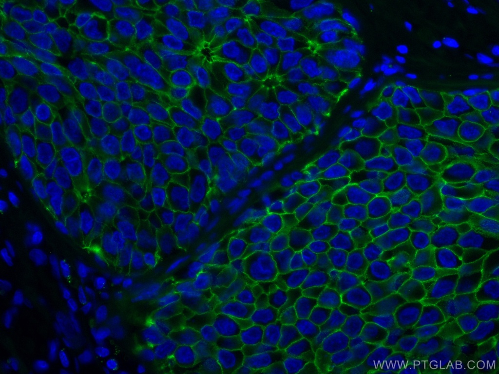 CoraLite®488-conjugated E-cadherin Monoclonal antibody