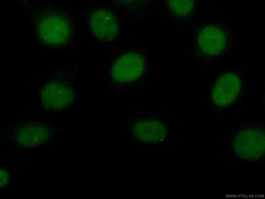 CoraLite®488-conjugated Transketolase Monoclonal antibody