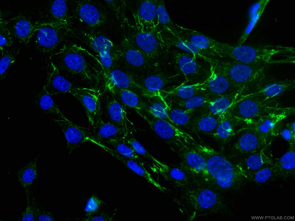CoraLite®488-conjugated Fibronectin Monoclonal antibody