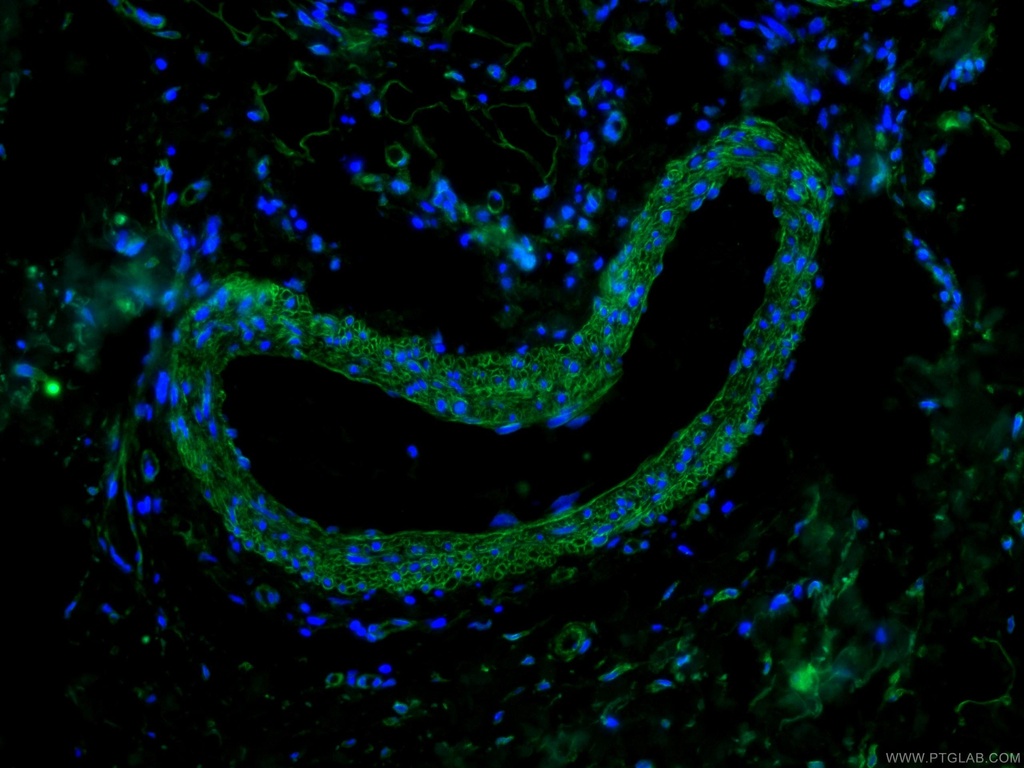 CoraLite®488-conjugated Caveolin-1 Monoclonal antibody