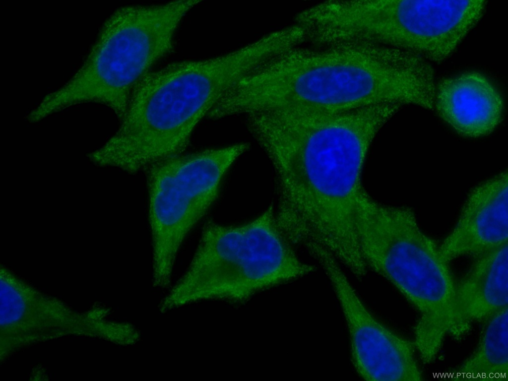 CoraLite®488-conjugated C3/C3b/C3c Monoclonal antibody