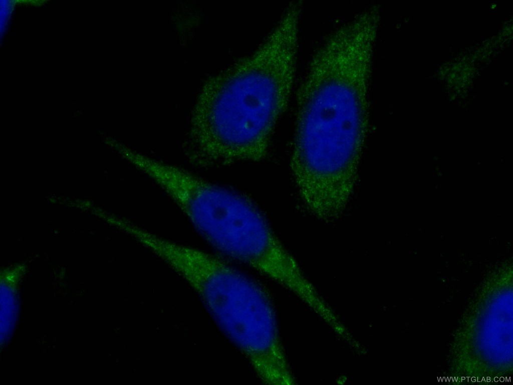 CoraLite®488-conjugated IDH1 Monoclonal antibody