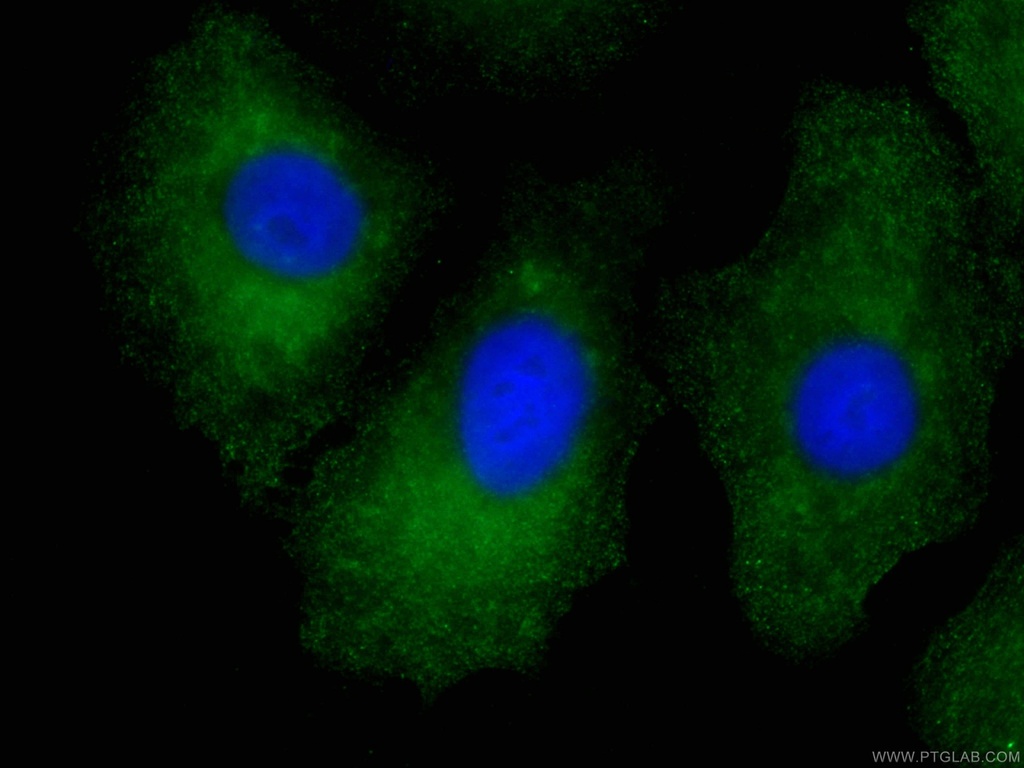 CoraLite®488-conjugated RSPO3 Monoclonal antibody
