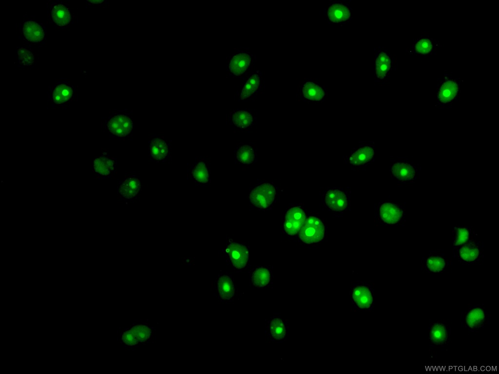 CoraLite®488-conjugated NSUN2 Monoclonal antibody