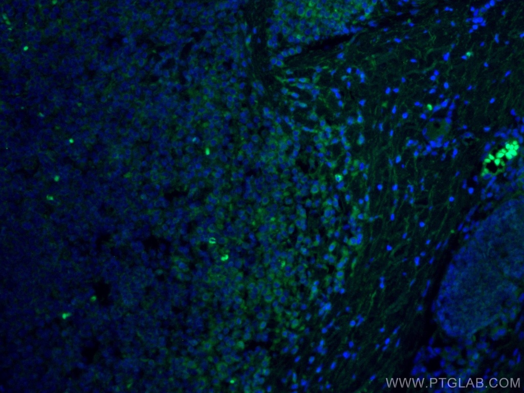 CoraLite®488-conjugated FYN Monoclonal antibody