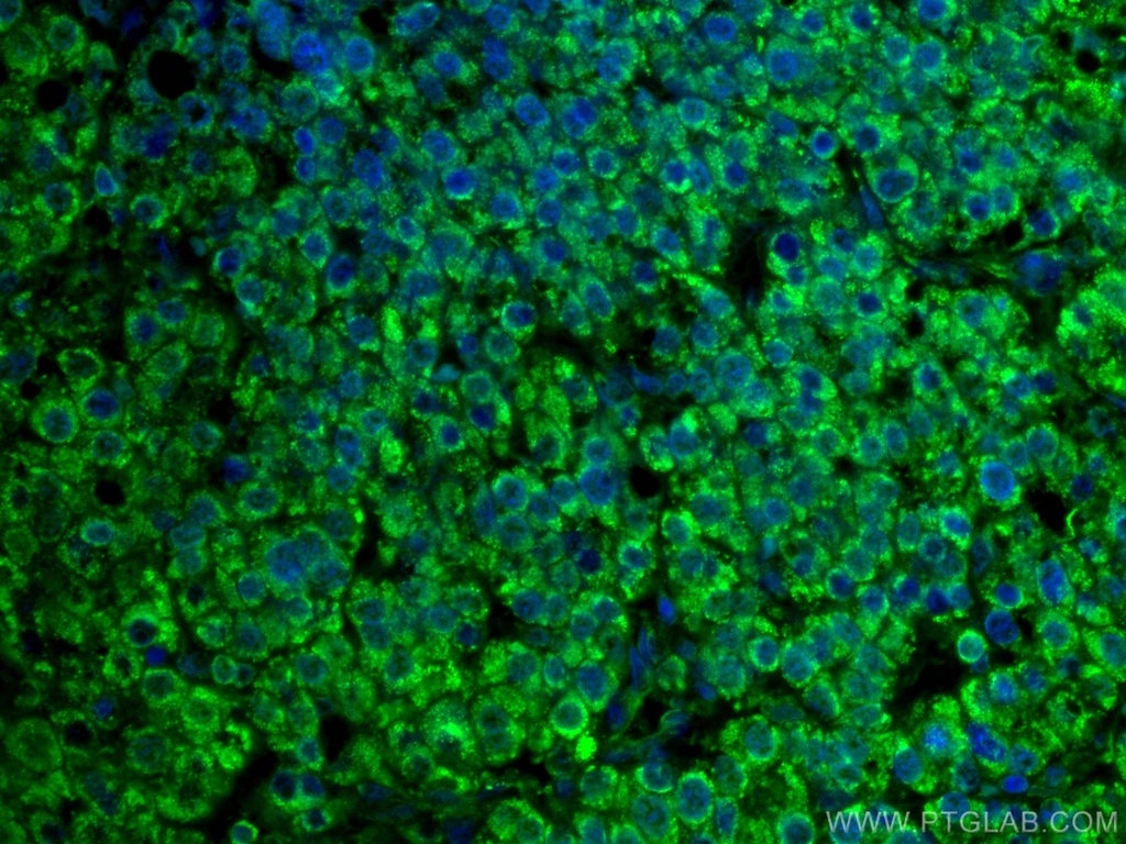 CoraLite®488-conjugated MLKL Monoclonal antibody