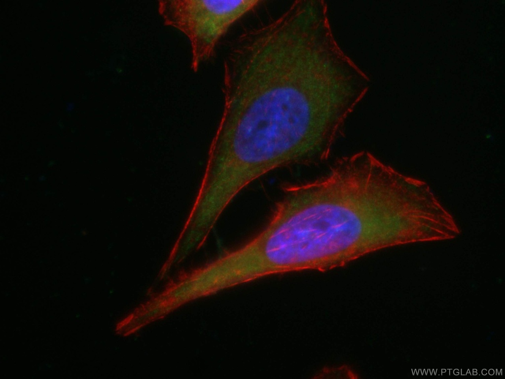CoraLite®488-conjugated TNFAIP3 Monoclonal antibody