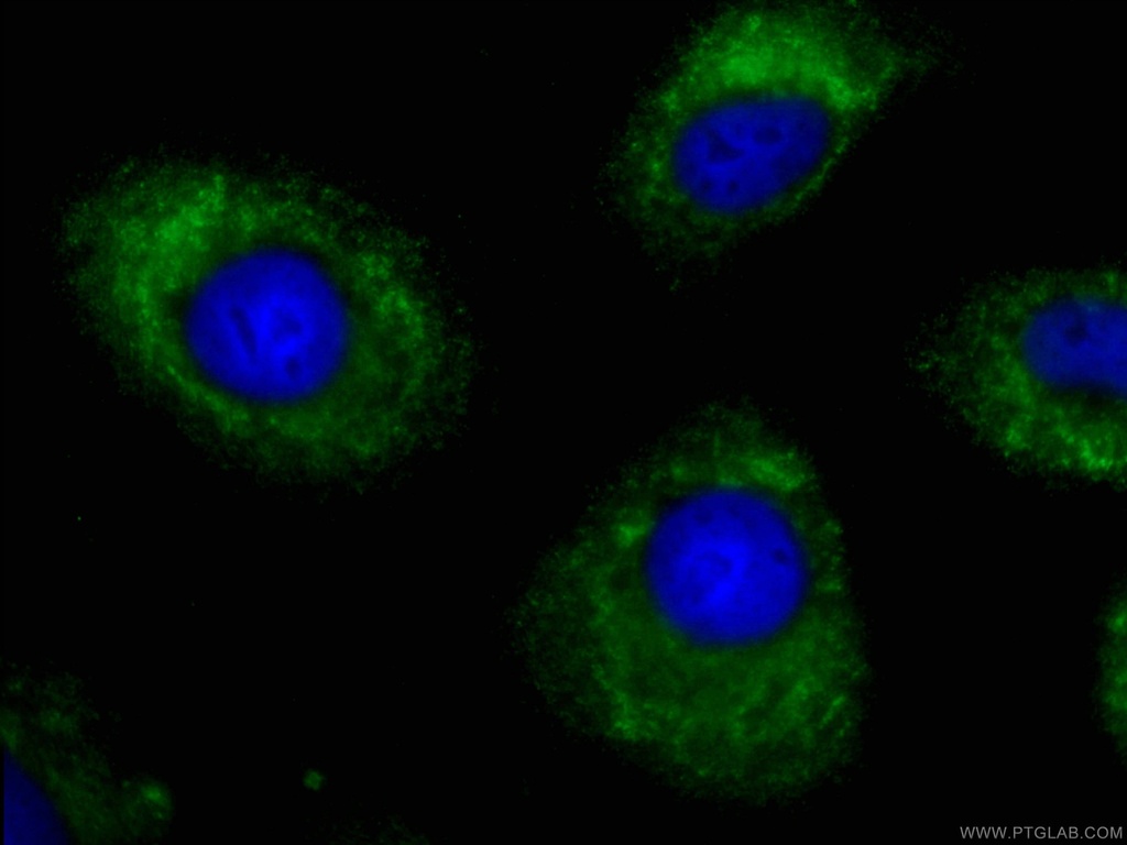CoraLite®488-conjugated FMO2 Monoclonal antibody