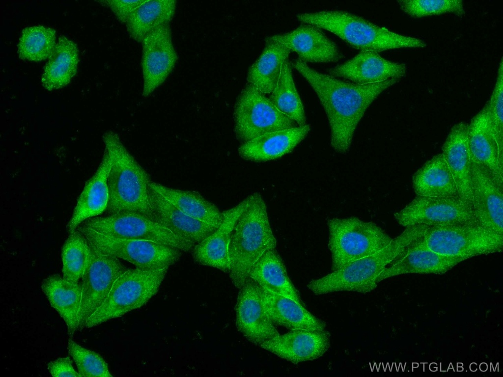 CoraLite®488-conjugated C1QA Monoclonal antibody