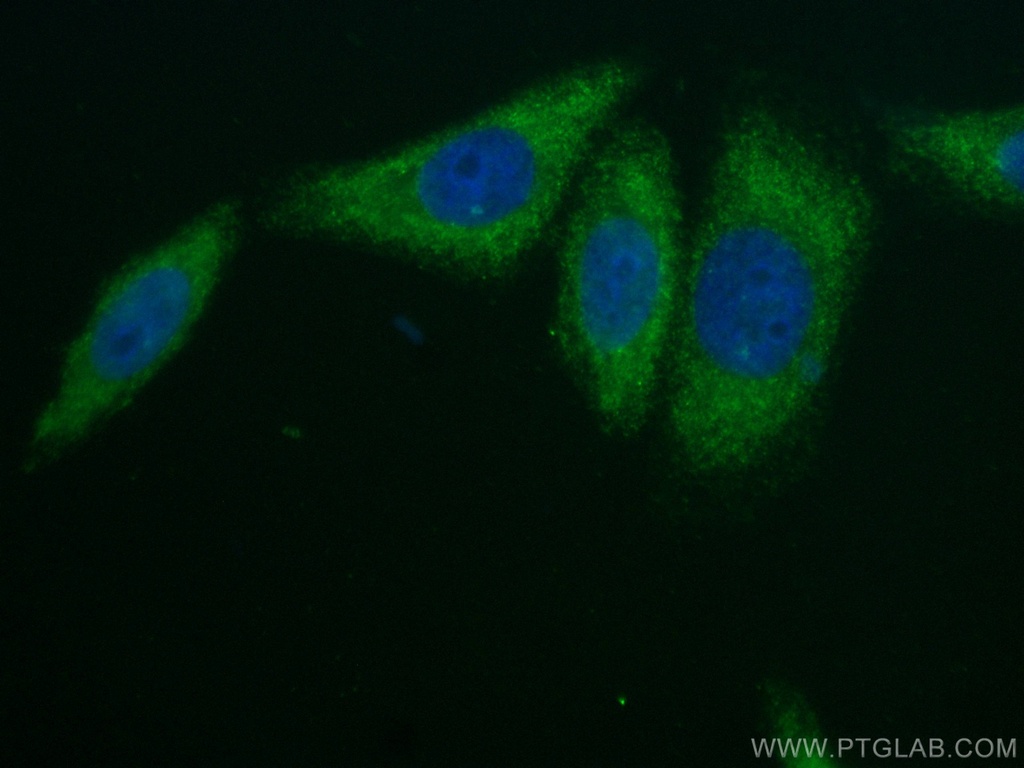 CoraLite®488-conjugated Alpha 2-Antiplasmin Monoclonal antibody