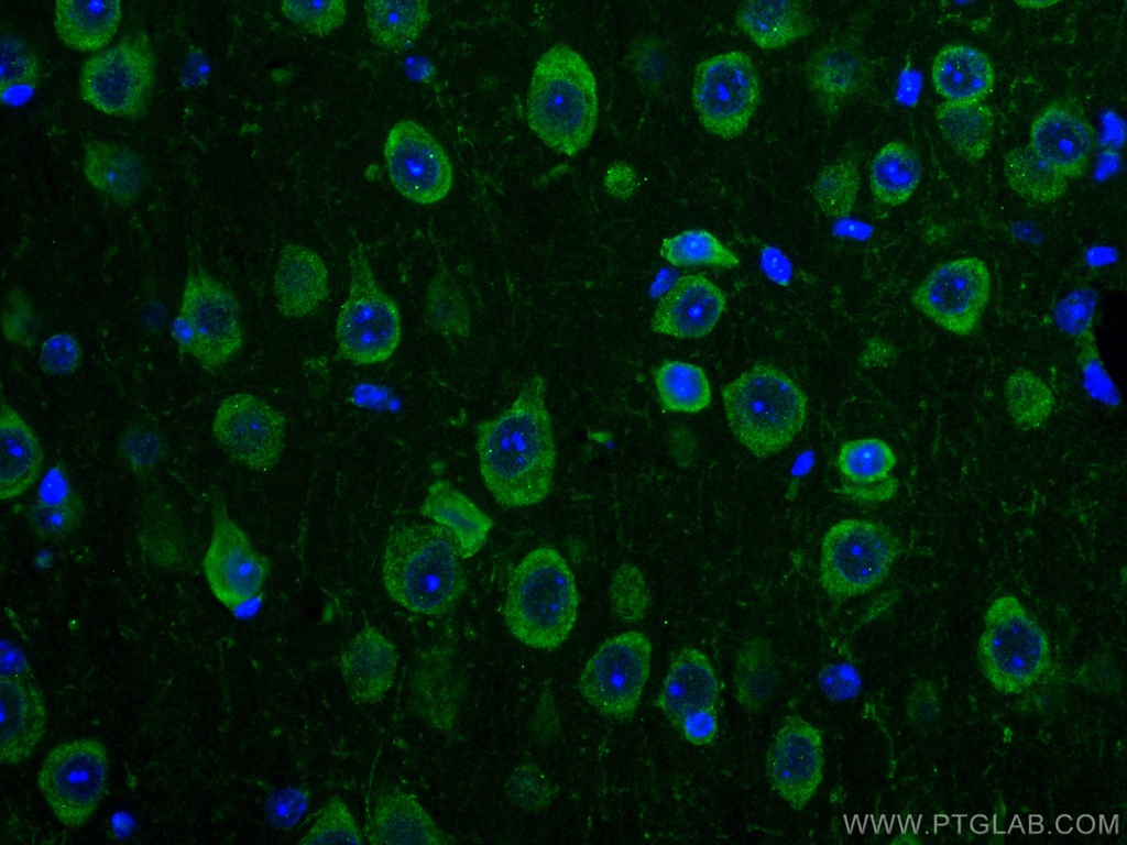 CoraLite®488-conjugated TRIM2 Monoclonal antibody