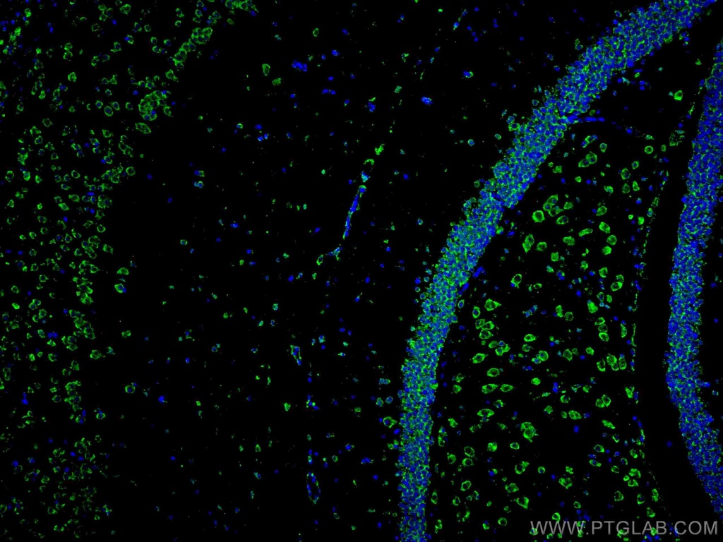 CoraLite®488-conjugated ACVR1 Monoclonal antibody