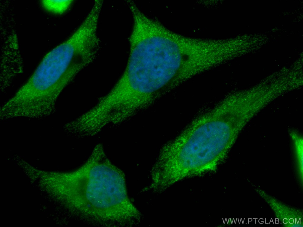 CoraLite®488-conjugated CMPK1 Monoclonal antibody