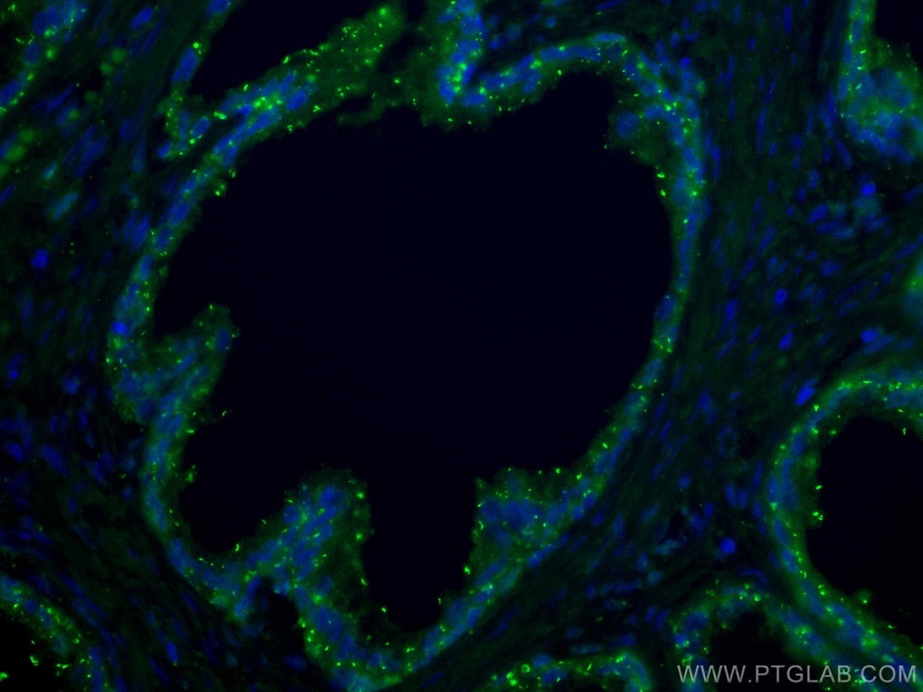 CoraLite®488-conjugated CTPS2 Monoclonal antibody