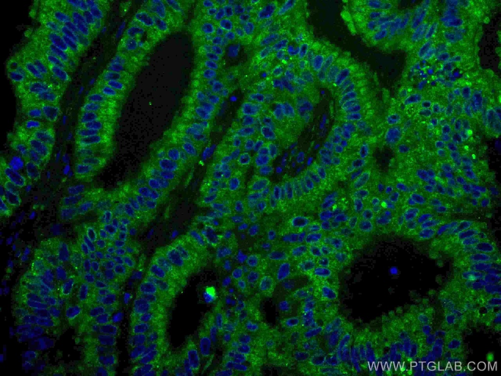 CoraLite®488-conjugated ING4 Monoclonal antibody