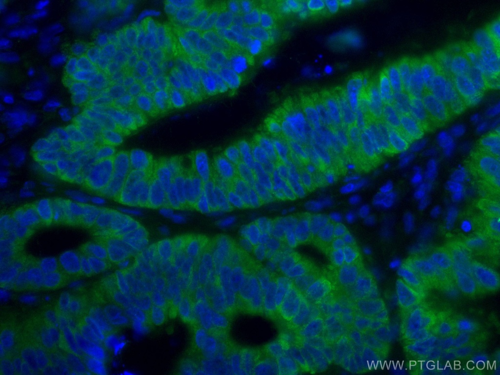 CoraLite®488-conjugated CNOT4 Monoclonal antibody