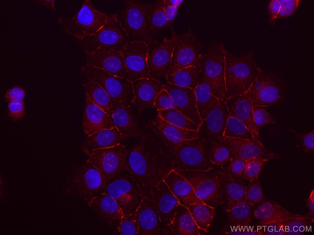 CoraLite®555-conjugated Beta Catenin Polyclonal antibody
