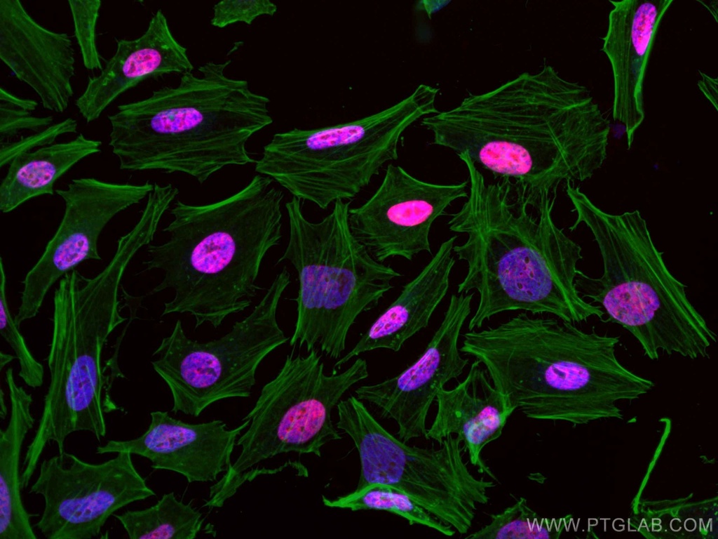 CoraLite®594-conjugated CREST Polyclonal antibody