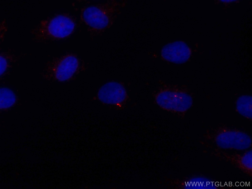 CoraLite®594-conjugated IFT88 Polyclonal antibody