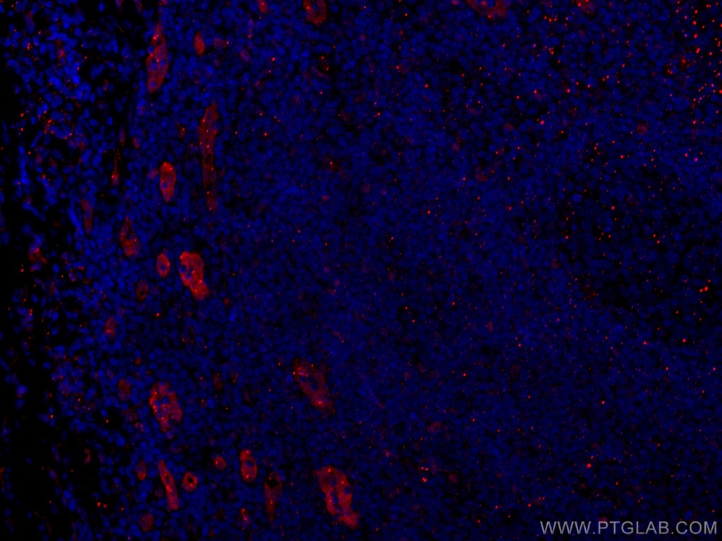 CoraLite®594-conjugated ACKR2 Monoclonal antibody