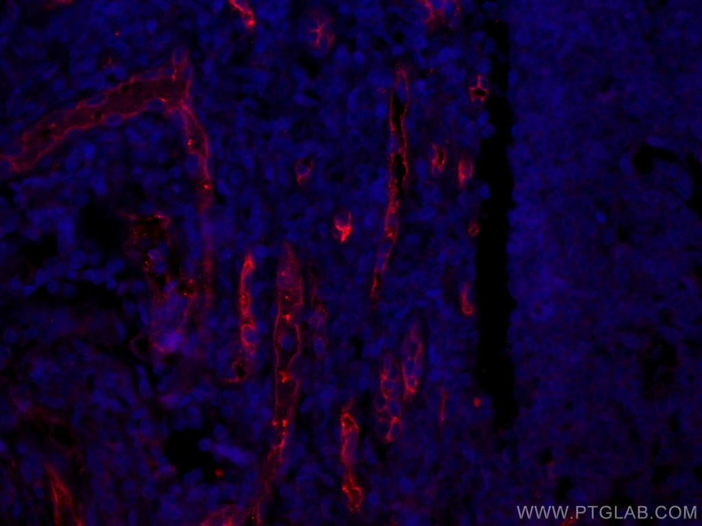 CoraLite®594-conjugated CD34 Monoclonal antibody