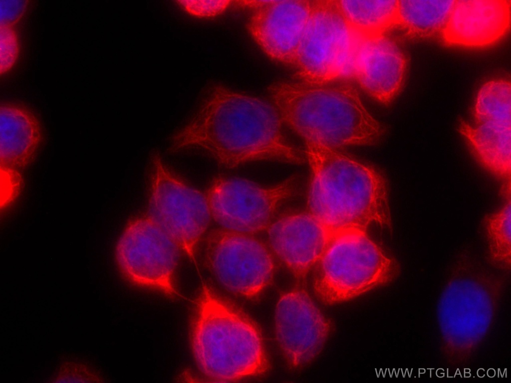 CoraLite®594-conjugated Cytokeratin 20 Monoclonal antibody