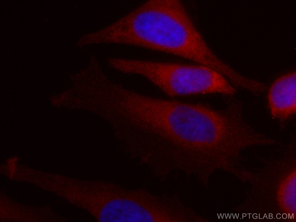 CoraLite®594-conjugated IL-1R2 Monoclonal antibody