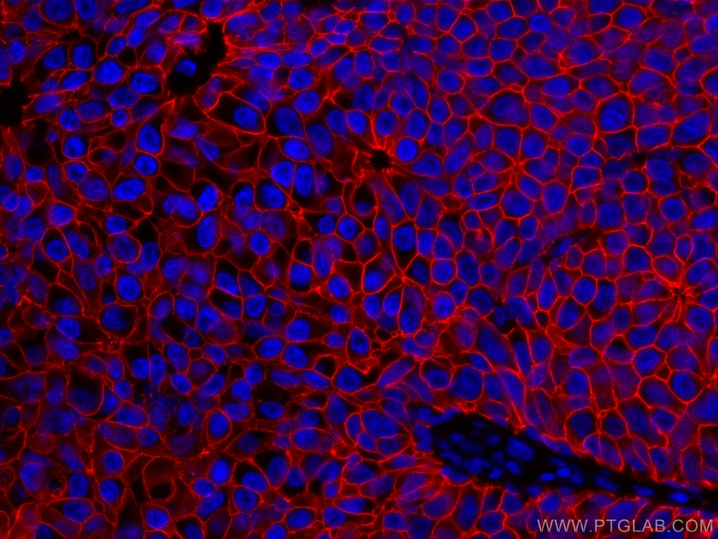 CoraLite®594-conjugated E-cadherin Monoclonal antibody