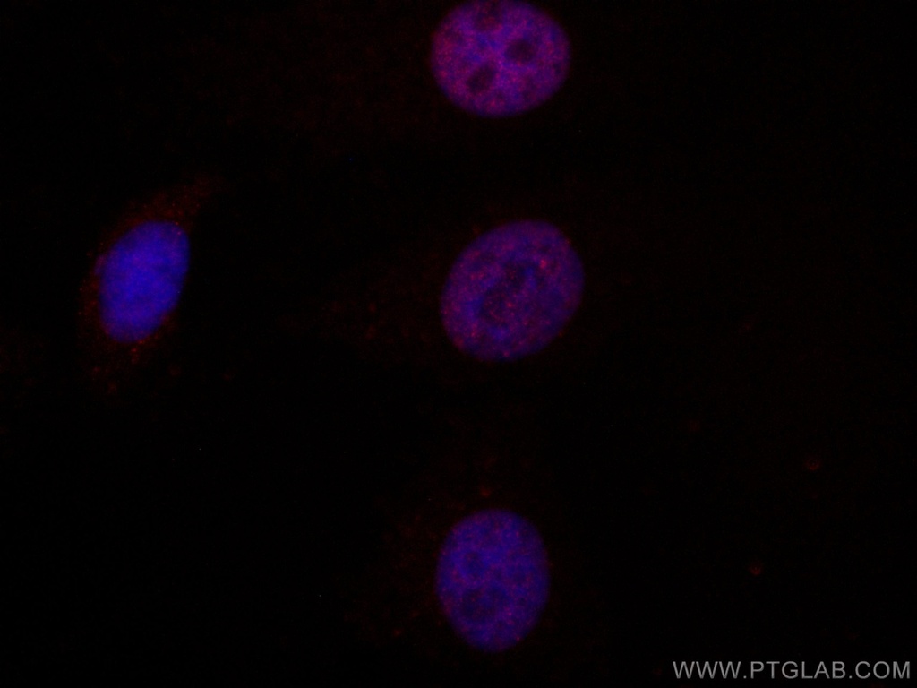 CoraLite®594-conjugated MUM1 Monoclonal antibody