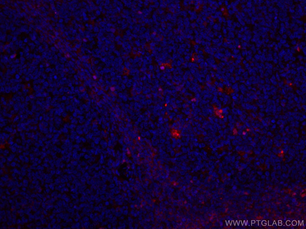 CoraLite®594-conjugated Alpha Antichymotrypsin Monoclonal antibody