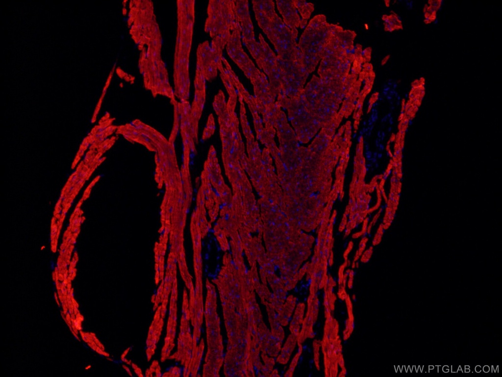 CoraLite®594-conjugated ACTC1-specific Monoclonal antibody