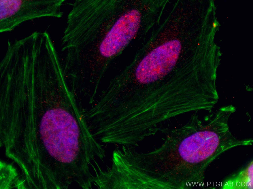 CoraLite®594-conjugated CHD4 Monoclonal antibody
