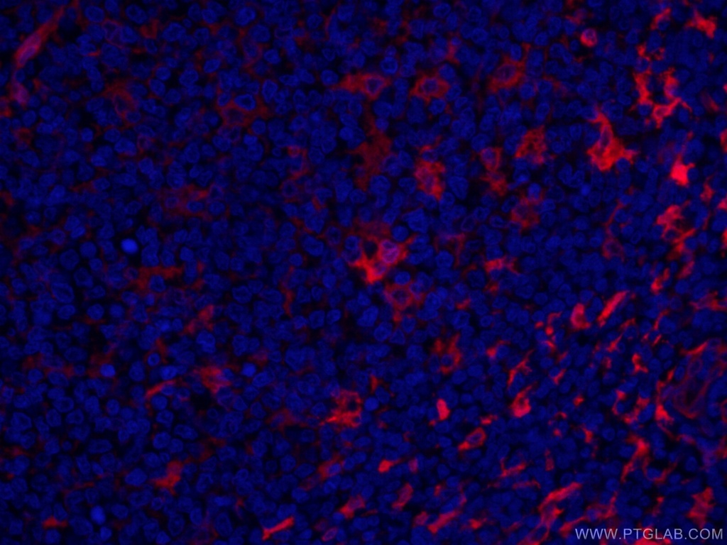 CoraLite®594-conjugated Fascin Monoclonal antibody