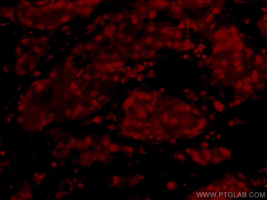 CoraLite®594-conjugated HRPT2; CDC73 Monoclonal antibody
