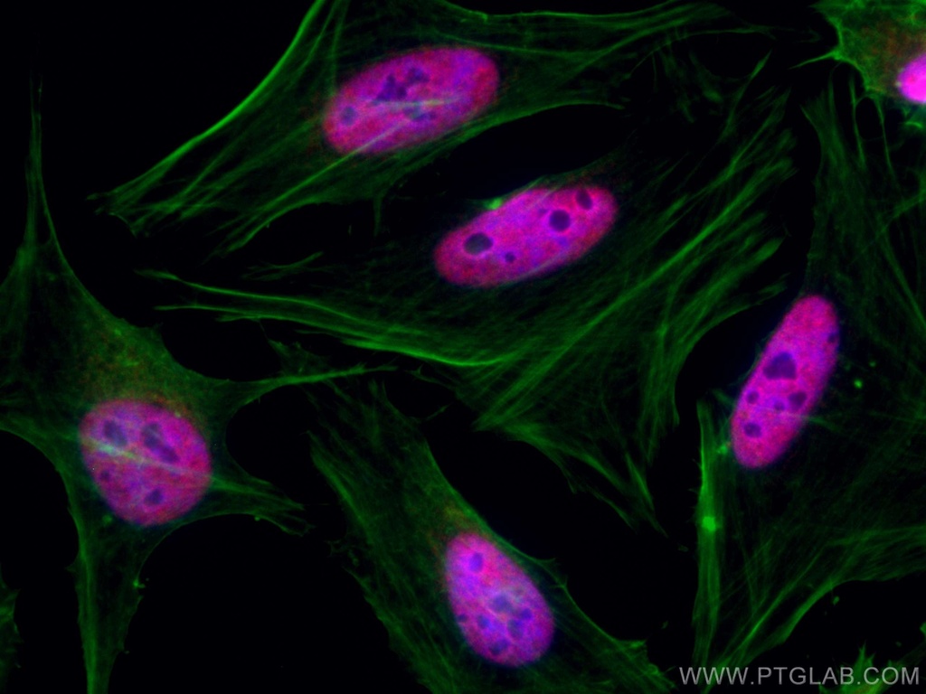 CoraLite®594-conjugated TBL1X Monoclonal antibody