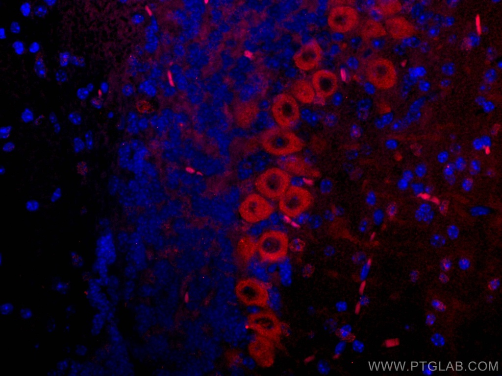 CoraLite®594-conjugated MYH10 Monoclonal antibody