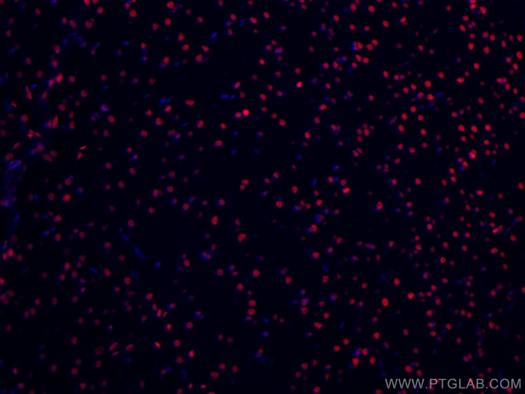 CoraLite®594-conjugated TDP-43 (C-terminal) Monoclonal antibody