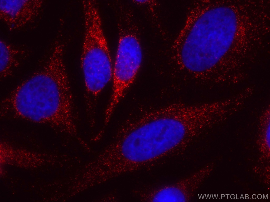 CoraLite®594-conjugated PNPLA3 Monoclonal antibody