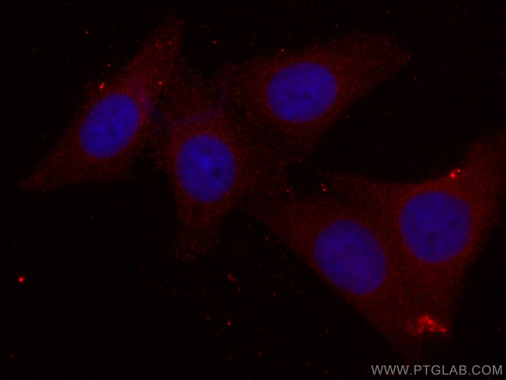 CoraLite®594-conjugated PPM1D Monoclonal antibody